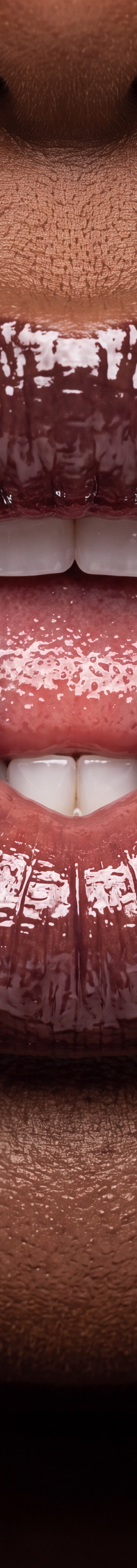 Macro Lip Pinch